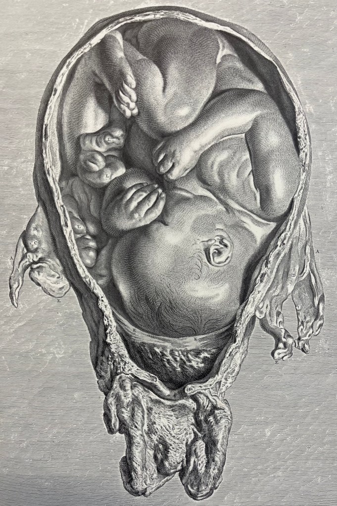 Plate XII from The Anatomy of the Human Gravid Uterus Exhibited in Figures by William Hunter